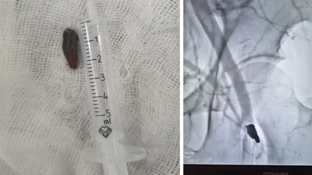 В Одесі прооперували 4-денну дитину з важкою вродженою вадою серця