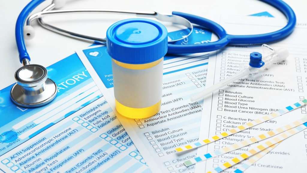 Підвищений рівень білка в сечі: лікар пояснив, що це означає