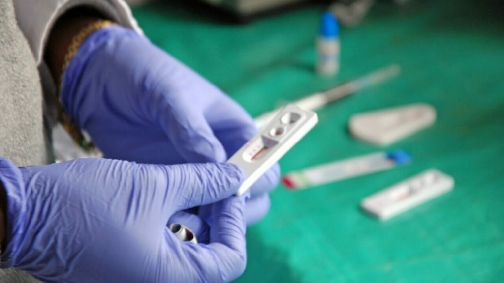 Статистика ВІЛ: у 2023 році від СНІДу померло більше тисячі українців