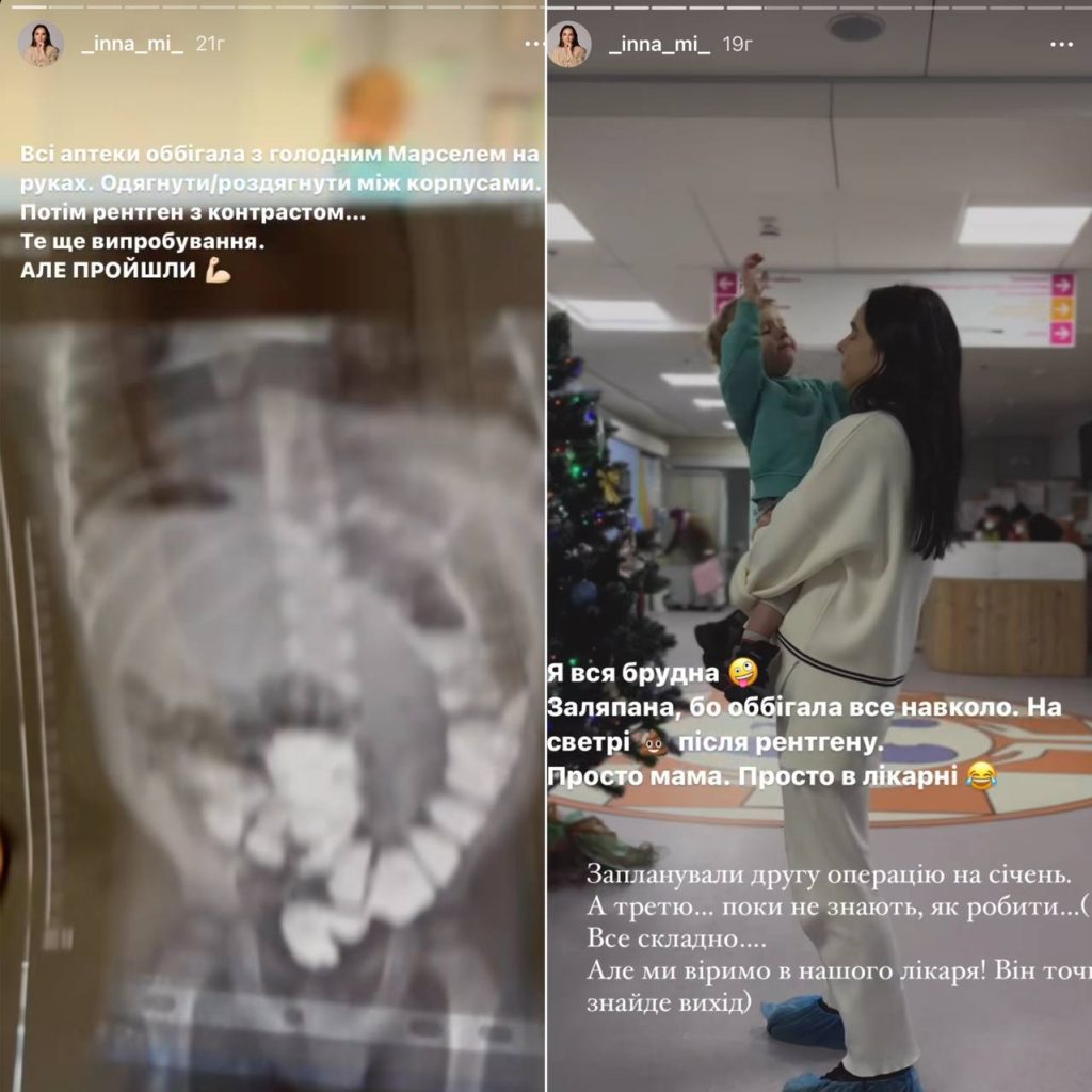 Усе складно: дружина Мірошниченка розповіла, що прийомного сина готують до другої операції