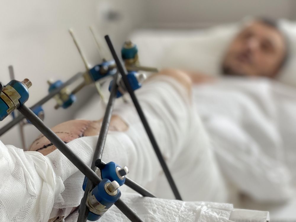 Благодійники та бізнес підсилюють державу та допомагають рятувати важкопоранених українців