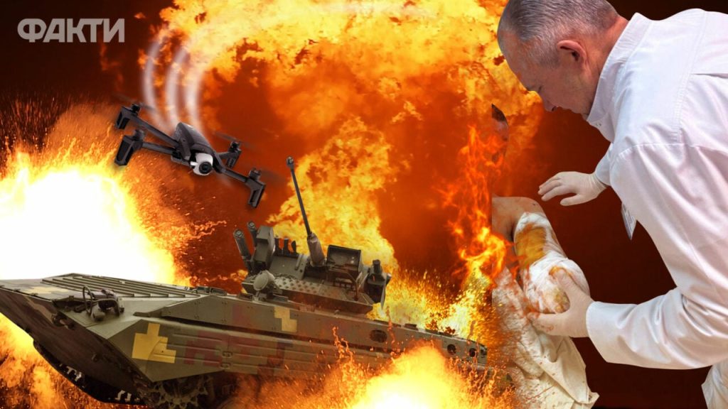 Осколками прошило легені, відірвало ногу: на Франківщині проходить реабілітацію 32-річний воїн