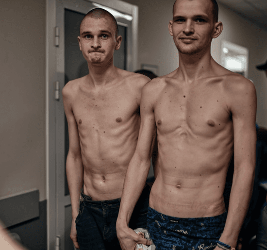 Російський полон вбиває: фото військових, які були звільнені 25 червня