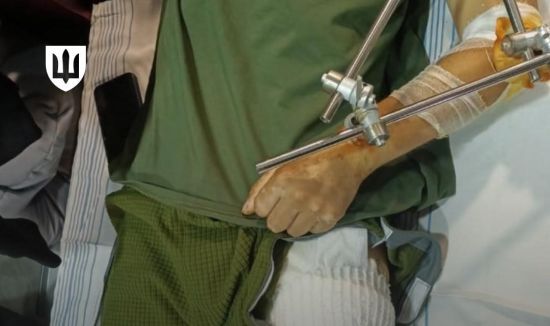 Військові отримають спеціальний одяг для поранених: в чому його особливість