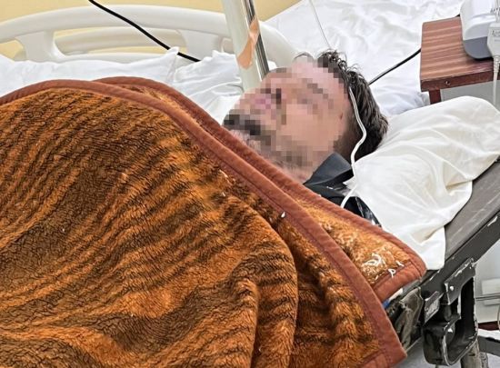 Не дійшов 700 метрів: біля кордону з Румунією знайшли чоловіка (фото)