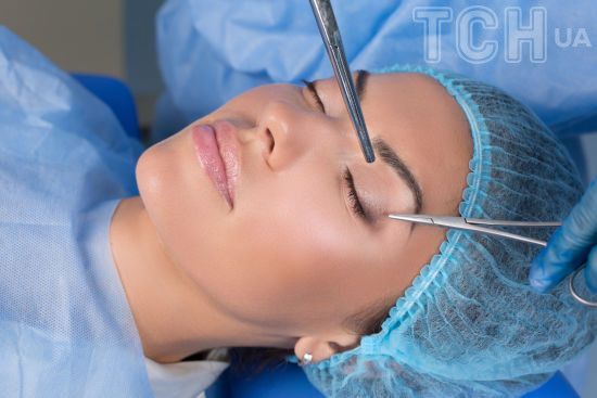 Око жінки пришили до повіки: який вона має вигляд після невдалої пластичної операції (фото)