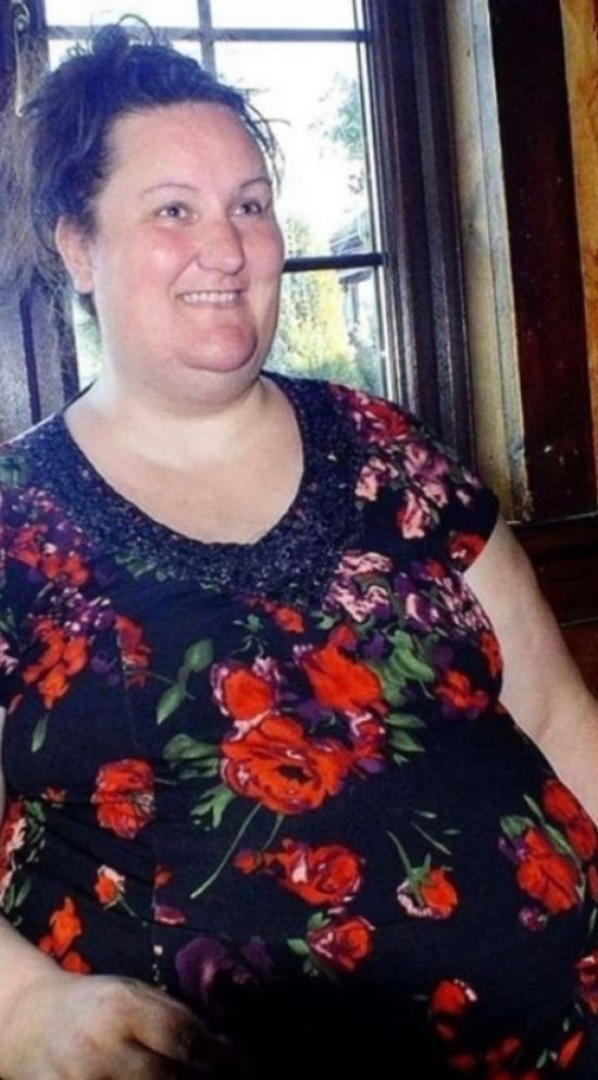 Продала коней і витратила гроші на нові обличчя та тіло: фото "до" і "після" 55-річної жінки