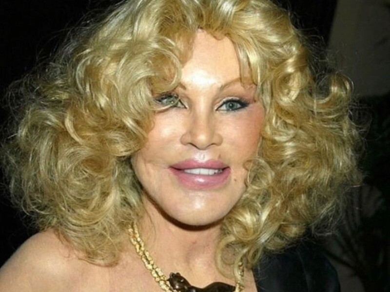 "Жінка-кішка" Вільденштейн показала, який вигляд мала в молодості до численних пластичних операцій. Фото