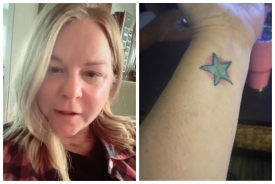 Жінці, яка втратила язик через рак, зробили новий з її руки: тепер на ньому є тату (фото)