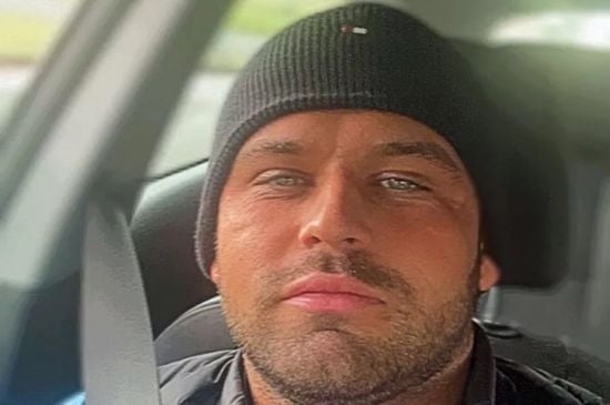 Голова чоловіка "роздулася" після того, як він спробував приховати декілька сивих волосин – фото