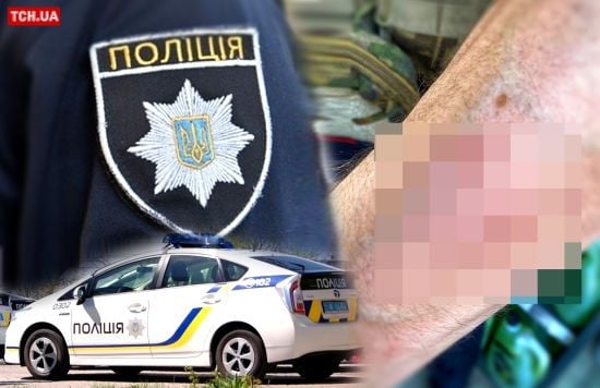 Вулична бійка з працівниками ТЦК та поліцією в Одесі: відкрито кримінальні провадження