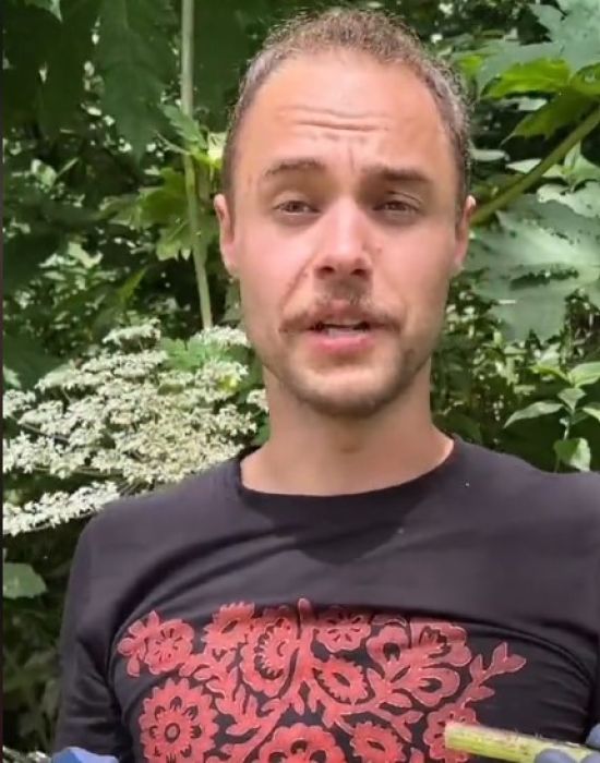 Українець шокував наслідками опіків борщівником – відео