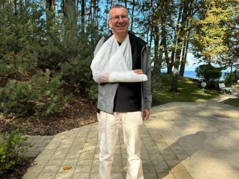 Президент Латвії зламав руку й кілька пальців, упавши з велосипеда Президент Латвії зламав руку й кілька пальців, упавши з велосипеда