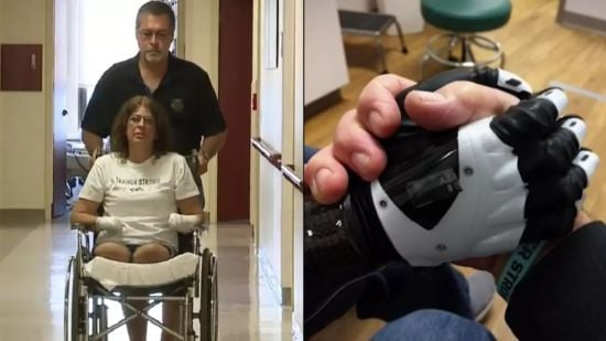 Жінка втратила всі кінцівки після "звичайної" дії, коли заходила до свого будинку (фото)