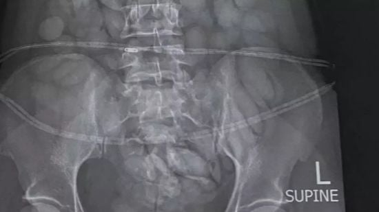 Жінку заарештували в аеропорту через її рентгенівський знімок: що там побачили (фото)