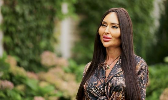 Українка з найбільшими вилицями відповіла, що буде з її тілом через 15 років після пластичних операцій