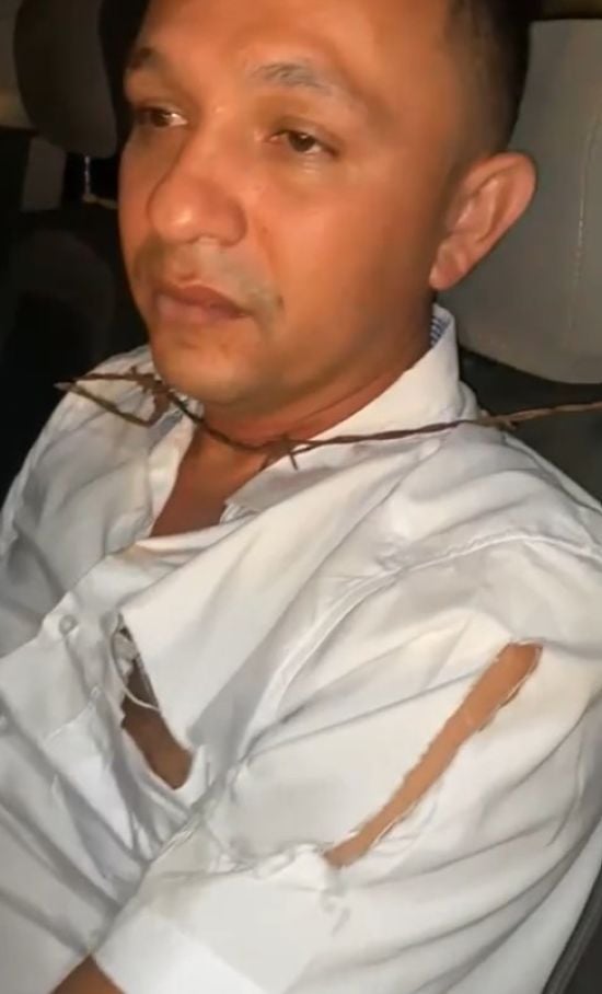 Кандидат у депутати з колючим дротом на шиї інсценував власне викрадення – кумедне відео