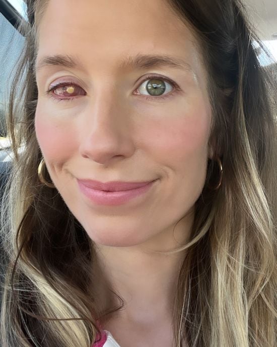 Жінка осліпла, припустившись помилки під час приймання душу: що сталося (фото)