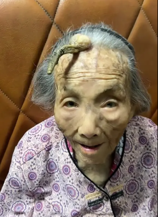 107-річна жінка з Китаю шокувала світ своїм "рогом довголіття" (фото)