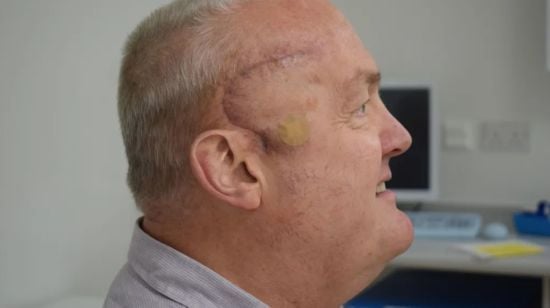 Агресивна пухлина чоловіка зменшилася на 50% за 6 тижнів після першого експериментального лікування