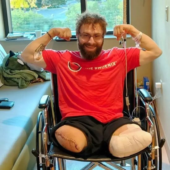 Чоловік втратив ноги в перший день на новій роботі: що сталося всього через 15 хв (фото)