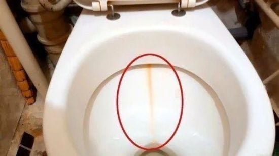 Як прибрати жовту смугу на унітаз: всі дієві способи