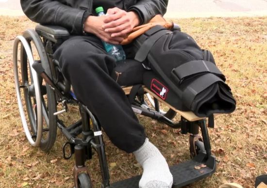 Хірурги ампутували чоловіку не ту ногу – фото