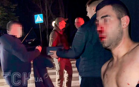 "Малая, ты поедешь с нами": всі деталі скандалу з Полтави, де коп і "авторитет" побили хлопця