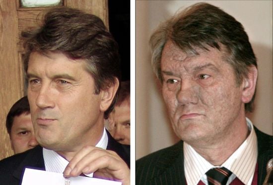 Розвідка США розсекретила інформацію про отруєння Ющенка Розвідка США розсекретила інформацію про отруєння Ющенка