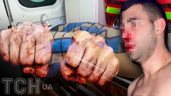 "Мала, ти їдеш з нами!": нові подробиці поліцейського скандалу на Полтавщині