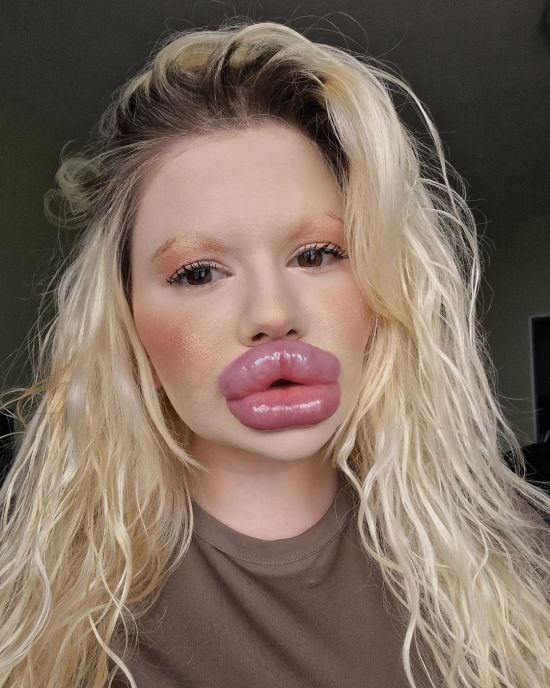 Жінка з найбільшими губами у світі показала, який має вигляд без макіяжу – фото