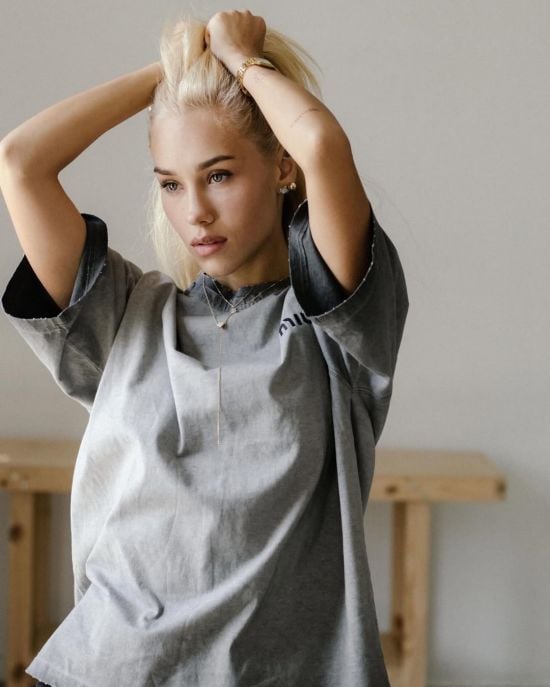 Блогерка Квіткова серйозно травмувалася на відпочинку й показала синці на тілі