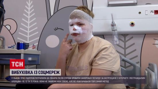 Вибухівка із соцмереж: троє підлітків потрапили до лікарні після спроби зробити саморобну петарду