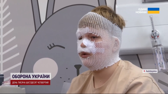 У Львові діти зробили вибухівку за інструкцією з TikTok: 12-річний хлопець розповів про моторошні наслідки У Львові діти зробили вибухівку за інструкцією з TikTok: 12-річний хлопець розповів про моторошні наслідки