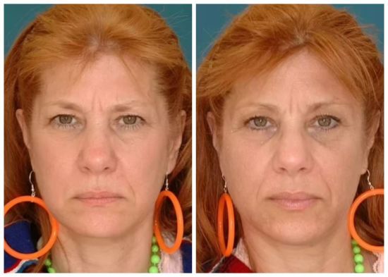 Одна близнючка розлучилася, а інша – перебувала у шлюбі: як це вплинуло на їхню зовнішність (фото)