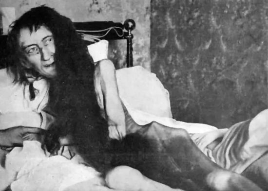 25 років у темряві: моторошна історія світської левиці, що шокує й досі (фото)