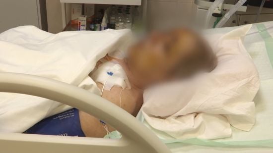 Розпочинала урок, коли пролунав вибух: у Дніпрі рятують вчительку з Покровська