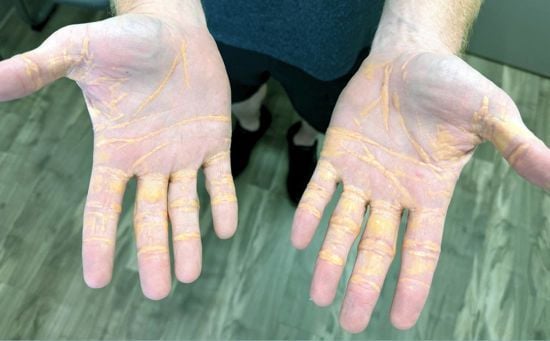 Дієта мала для чоловіка шокувальні наслідки: деталі, фото Дієта мала для чоловіка шокувальні наслідки: деталі, фото