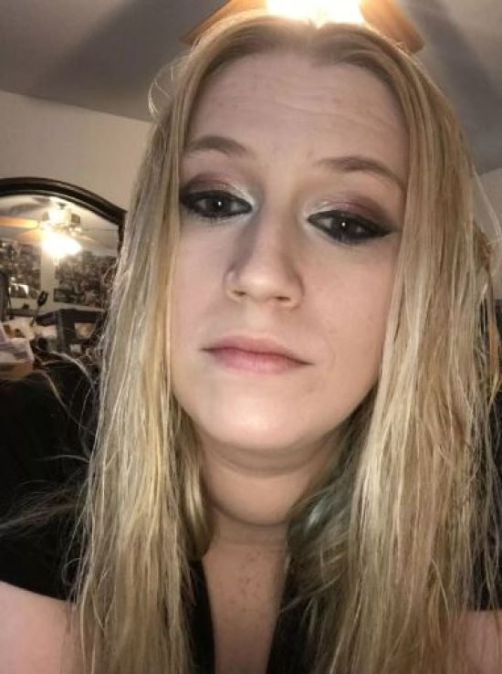 У жінки відпав ніс через вживання кокаїну: який вона має вигляд (фото)