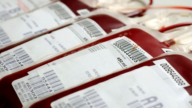 Що не можна робити перед здаванням крові: пояснює лікар