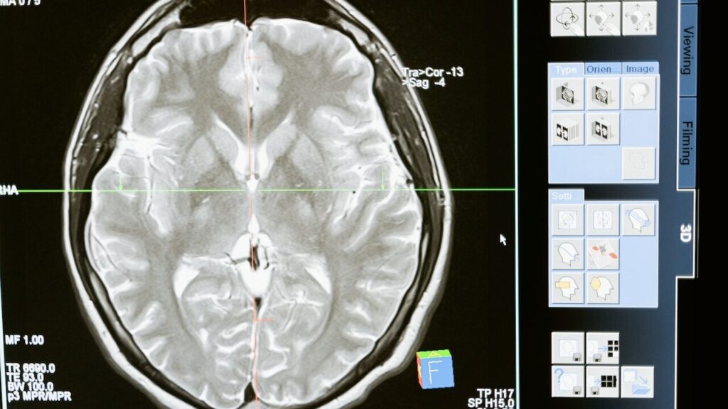 Болять нирки: що робити — розповів лікар