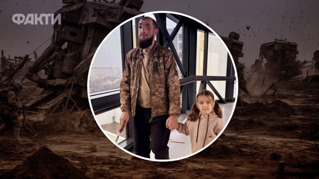 Переломи стегна, тазу, коліна: у Львові відновлюють 36-річного воїна, що був тренером до війни