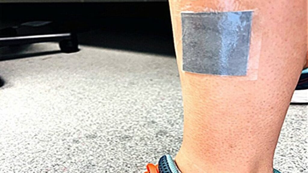 Наноквіти: дослідники розробили інноваційні пов’язки, що прискорюють загоєння ран