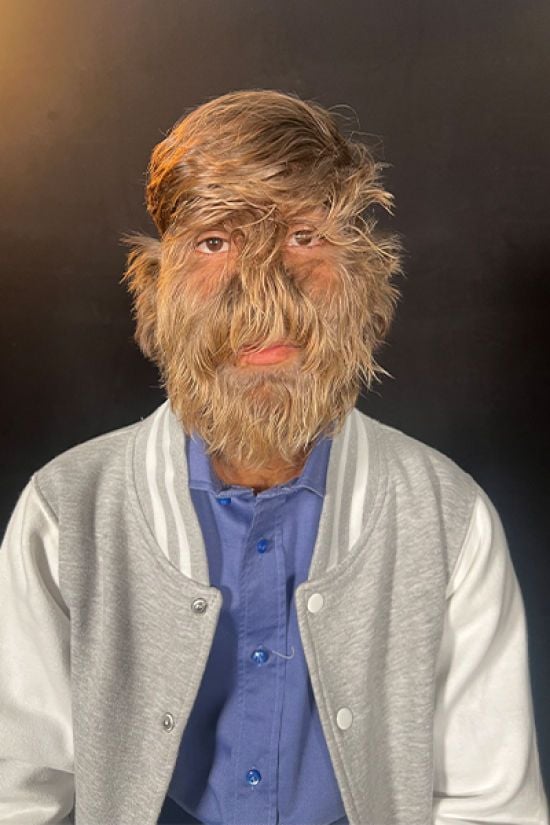 Чоловік із найволохатішим обличчям у світі: який вигляд має рекордсмен (фото)