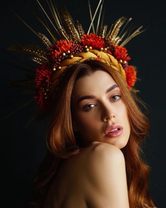 "Міс Україна Всесвіт" Суббота показалася в синцях і ранах та шокувала заявою про побиття коханим