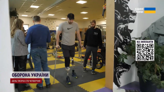 В Україні військових протезуватимуть по-новому: чому це важливо