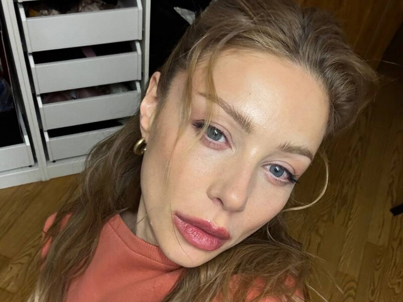 40-річна Тіна Кароль пояснила, чому їй доводиться робити ін'єкції ботоксу частіше, ніж зазвичай