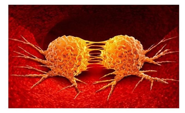 Що таке метастази, на якій стадії вони з’являються, чи можуть зникнути: відповіді онкологів