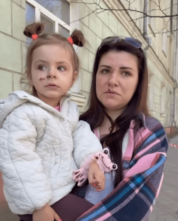«Мала в той день сказала — надінь хрестик»: жінка розповіла, як з дитиною пережила удар по Сумах