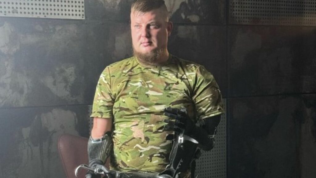 Попри важкі травми, відкрив власний бізнес – історія ветерана